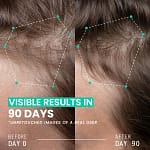 Hair Thickening Dual Action Routine – 90 Day Anti Hair Loss Solution – 3 Month Intensive Programme Bahrain Mega Deals Best Online Shopping Deals and Discounts in Bahrain, GCC 12