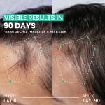 Hair Thickening Dual Action Routine – 90 Day Anti Hair Loss Solution – 3 Month Intensive Programme Bahrain Mega Deals Best Online Shopping Deals and Discounts in Bahrain, GCC 13