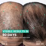 Hair Thickening Dual Action Routine – 90 Day Anti Hair Loss Solution – 3 Month Intensive Programme Bahrain Mega Deals Best Online Shopping Deals and Discounts in Bahrain, GCC 14