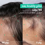 روتين مزدوج الفعالية لتكثيف الشعر – حل لتساقط الشعر في 90 يوم – برنامج مكثف لمدة 3 أشهر Bahrain Mega Deals Best Online Shopping Deals and Discounts in Bahrain, GCC 19